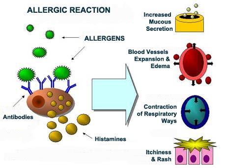 иммунная система аллергиков